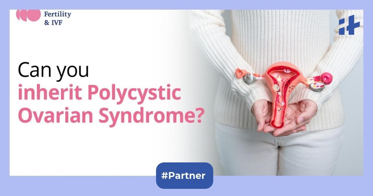Can you inherit Polycystic Ovarian Syndrome? Understanding the genetic linkage behind PCOS