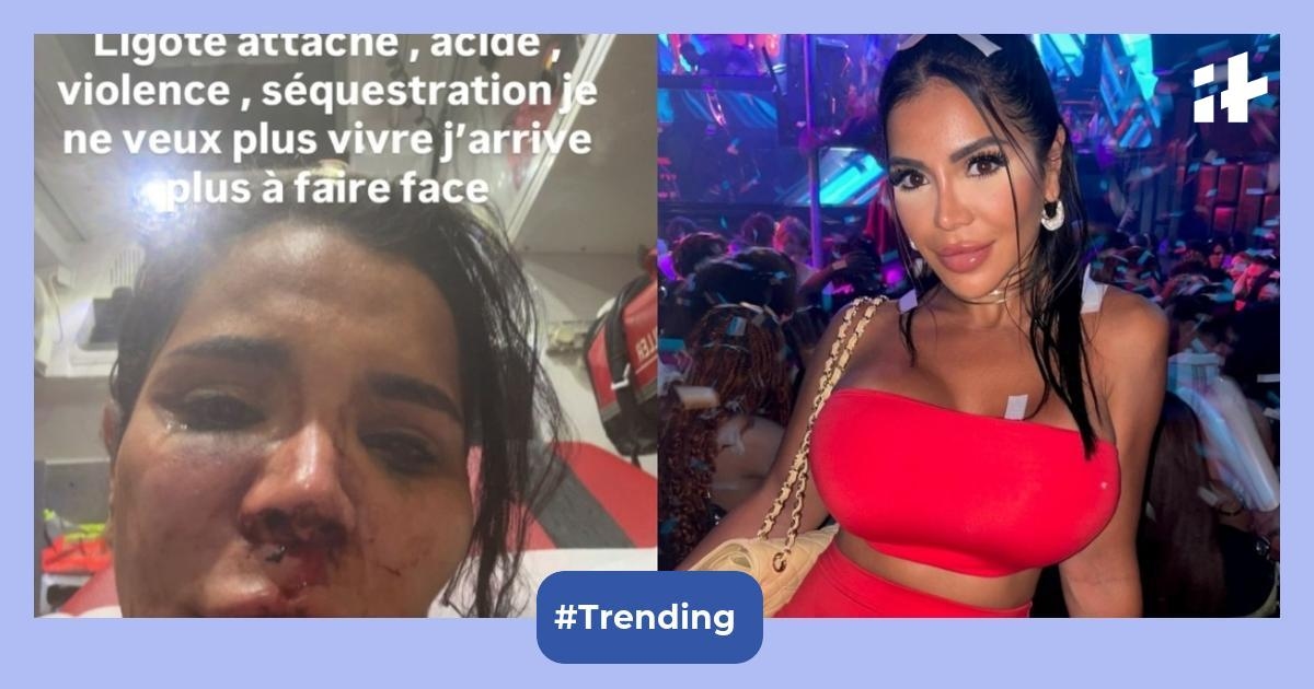 Who is Soraya Riffy? French influencer sexually assaulted, ‘disfigured' in violent home invasion shares heartbreaking message