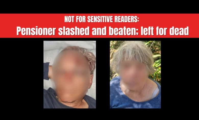 Pensioner attacked with panga, wife fights off robbers on Mpumalanga farm