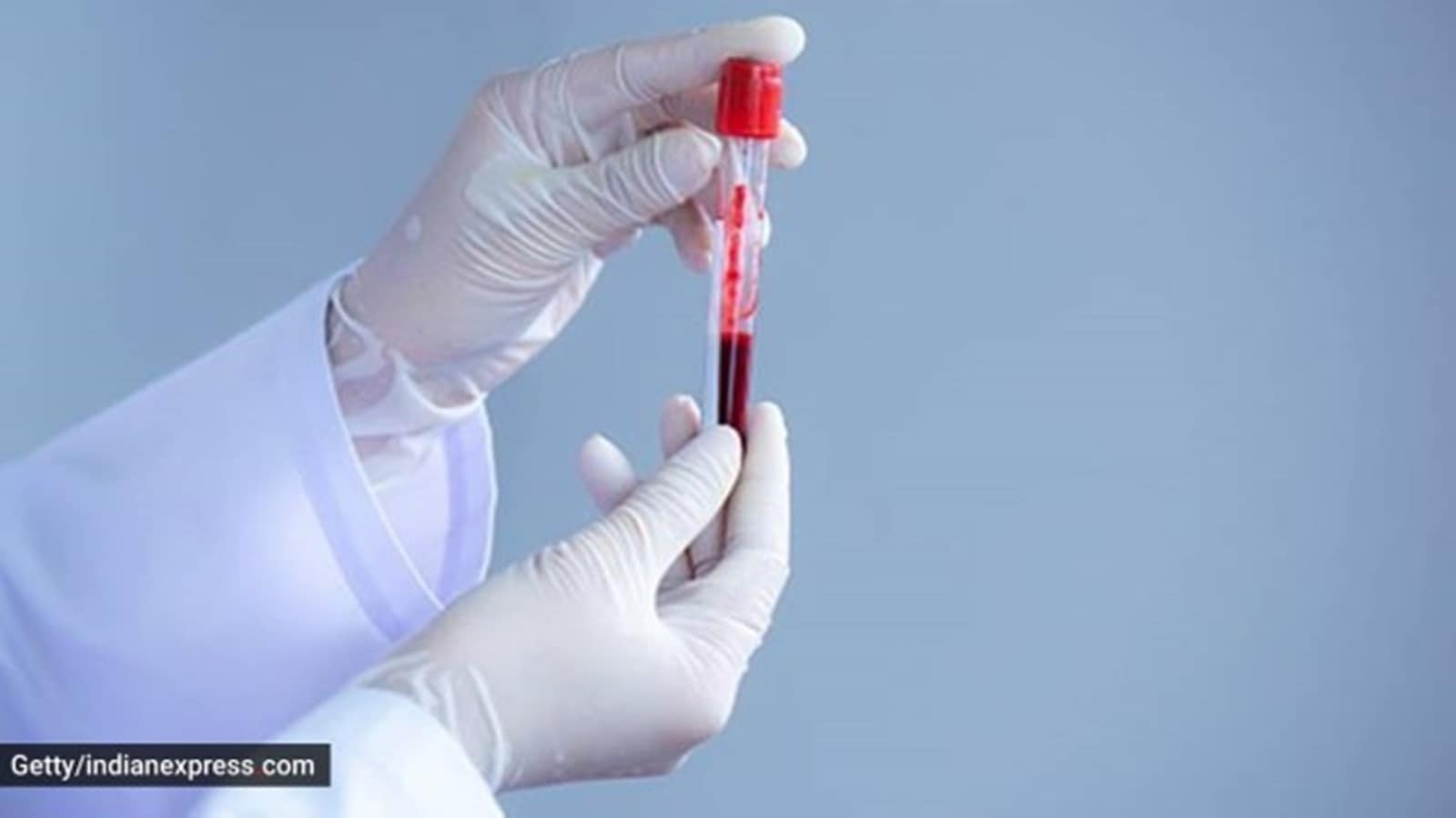 Blood test detects 30 different types of cancers with 98.4% accuracy: Study