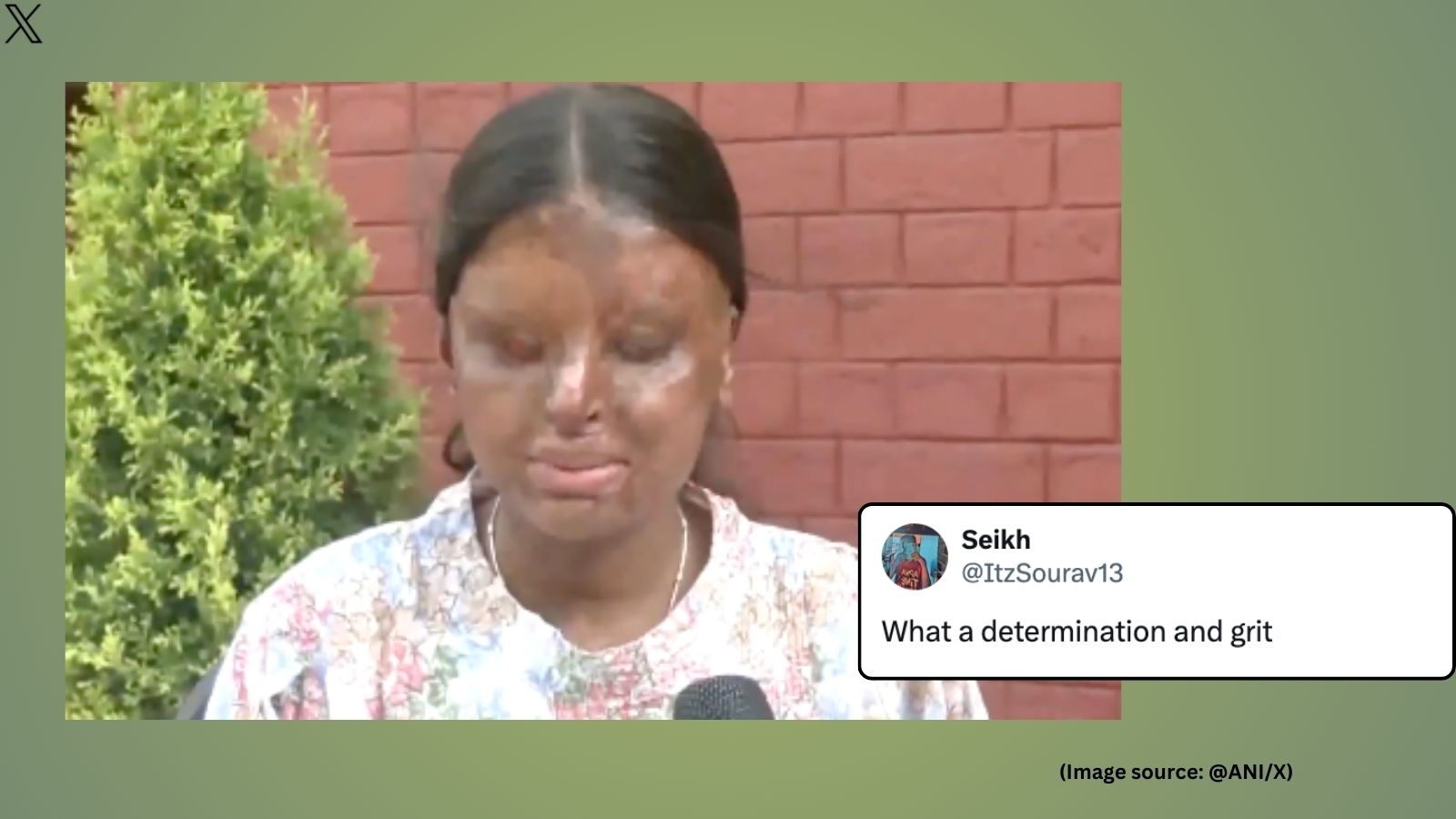 ‘We will have to be humble': Chandigarh acid attack survivor scores 95.6% in Class 12 CBSE boards, aspires to be an IAS officer