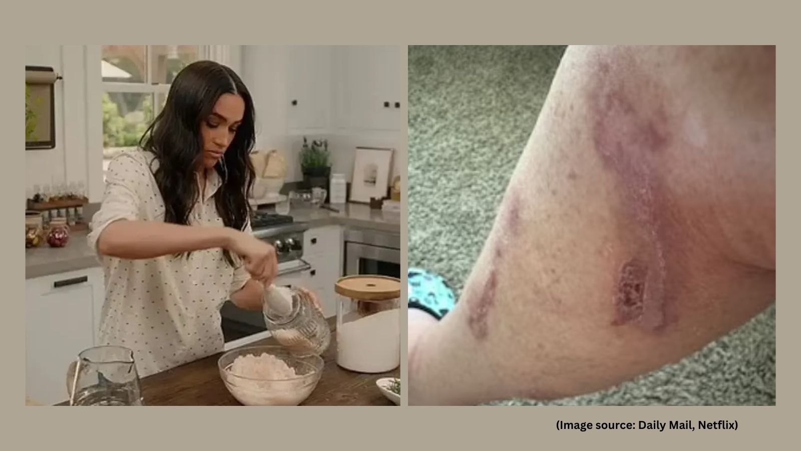Meghan Markle's fan threatens $10 million lawsuit after duchess' bath salts recipe caused ‘catastrophic burns'