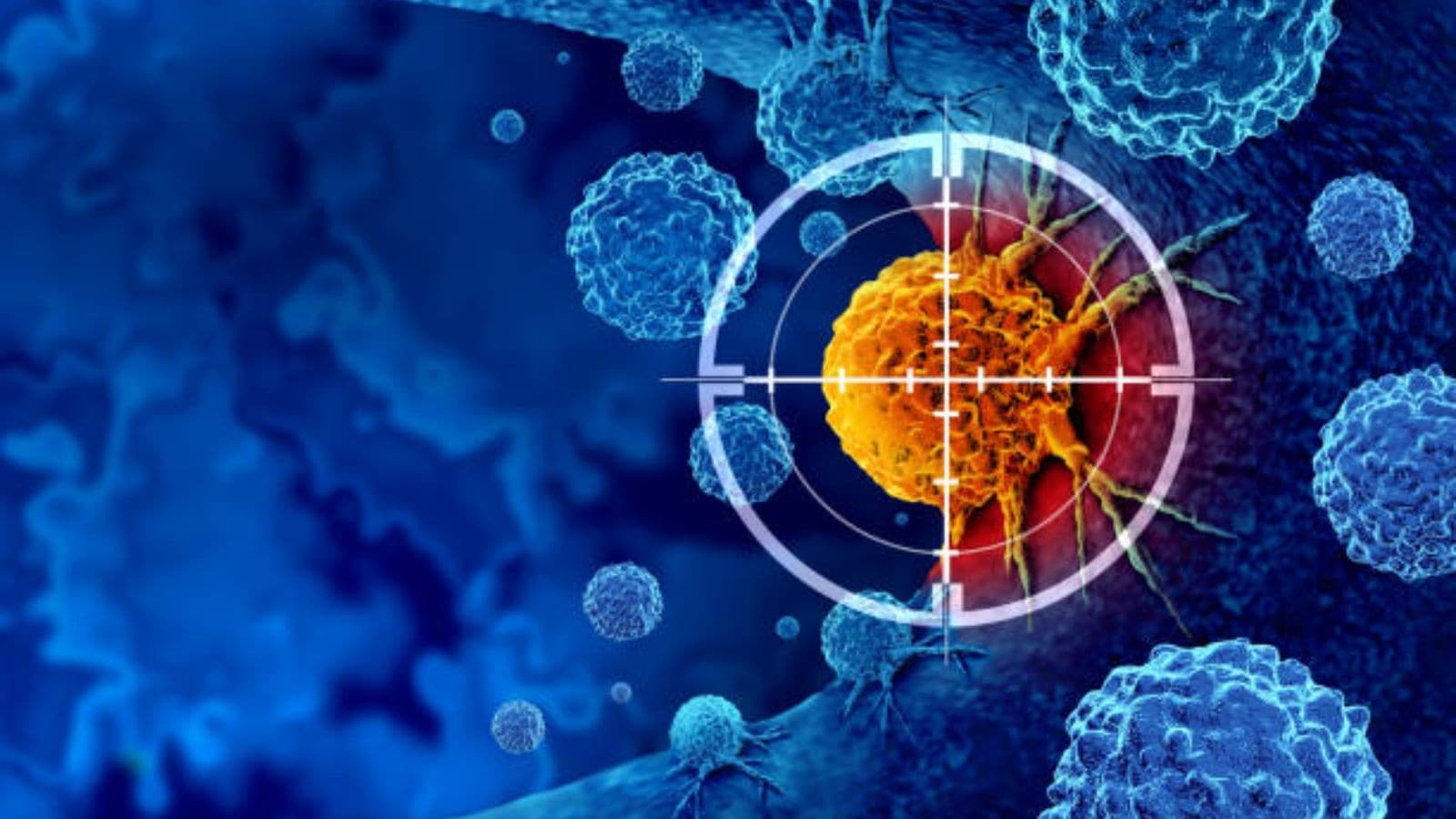 Lancet study shows drug resistance three times higher in cancer patients: What are risk factors?