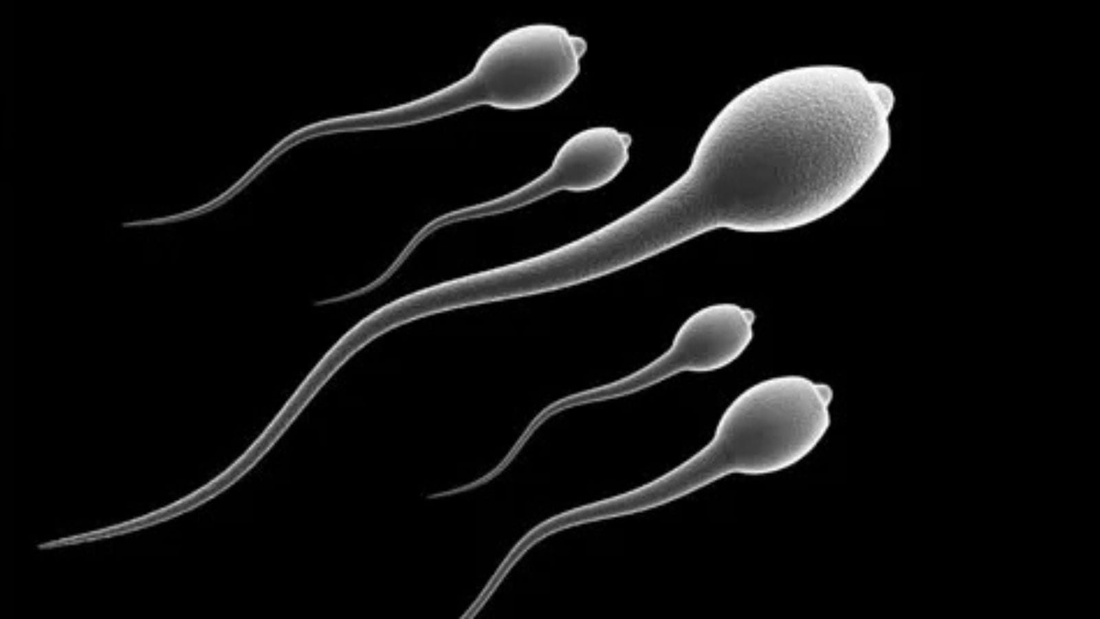 Sperm donor with cancer-linked mutation fathered 67 children across Europe; 10 diagnosed with cancer