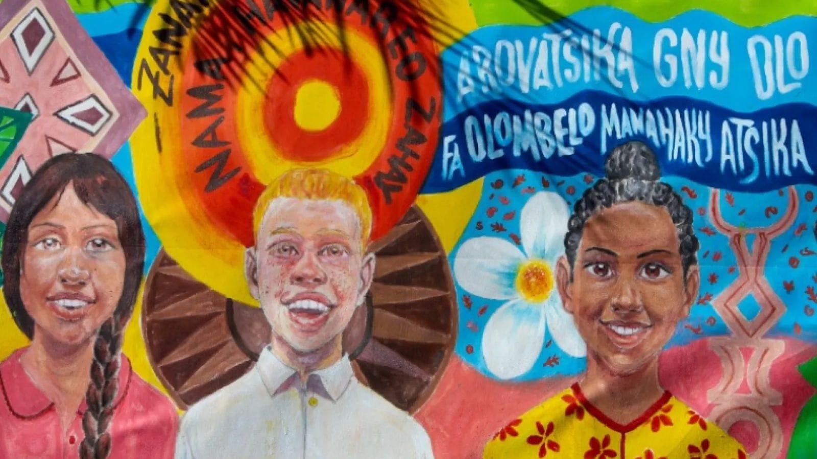 International Albinism Awareness Day 2025: What is albinism? Know the day's theme, history, and significance