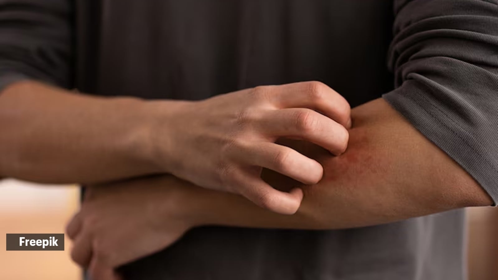 Debunked: Common myths surrounding desi nuskhas promising to cure bee stings