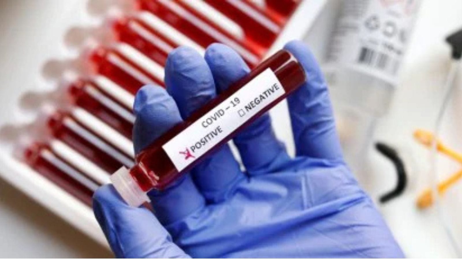 Covid 19 Cases Live Updates: Active cases rise to nearly 5,000, 7 deaths reported in 24 hours