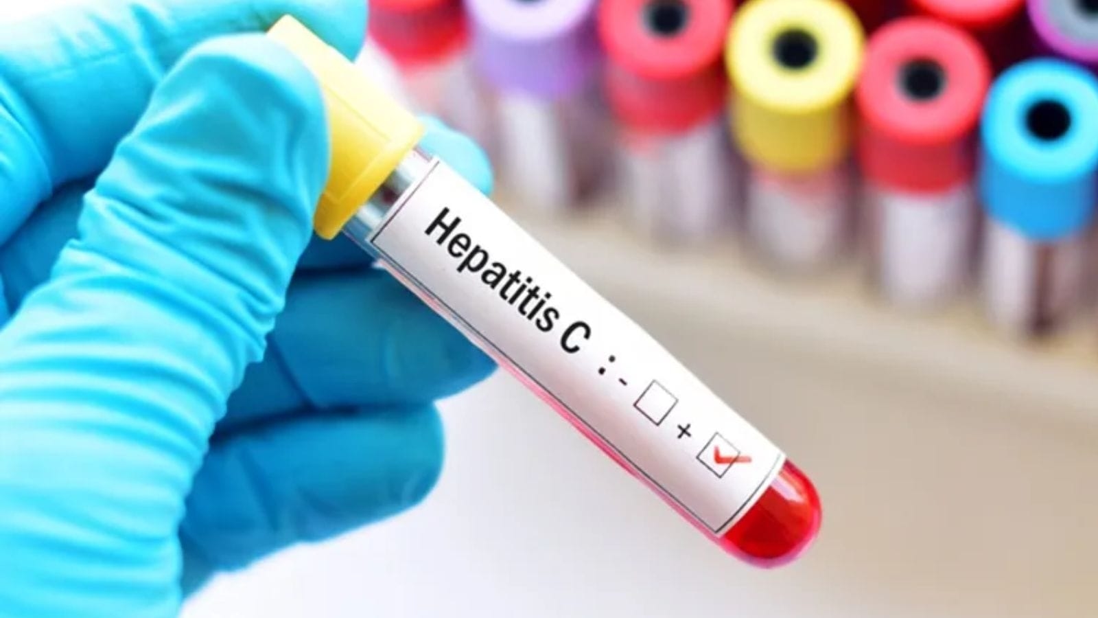 ‘Punjab high-burden state for hepatitis C, possibly due to intravenous drug abuse'