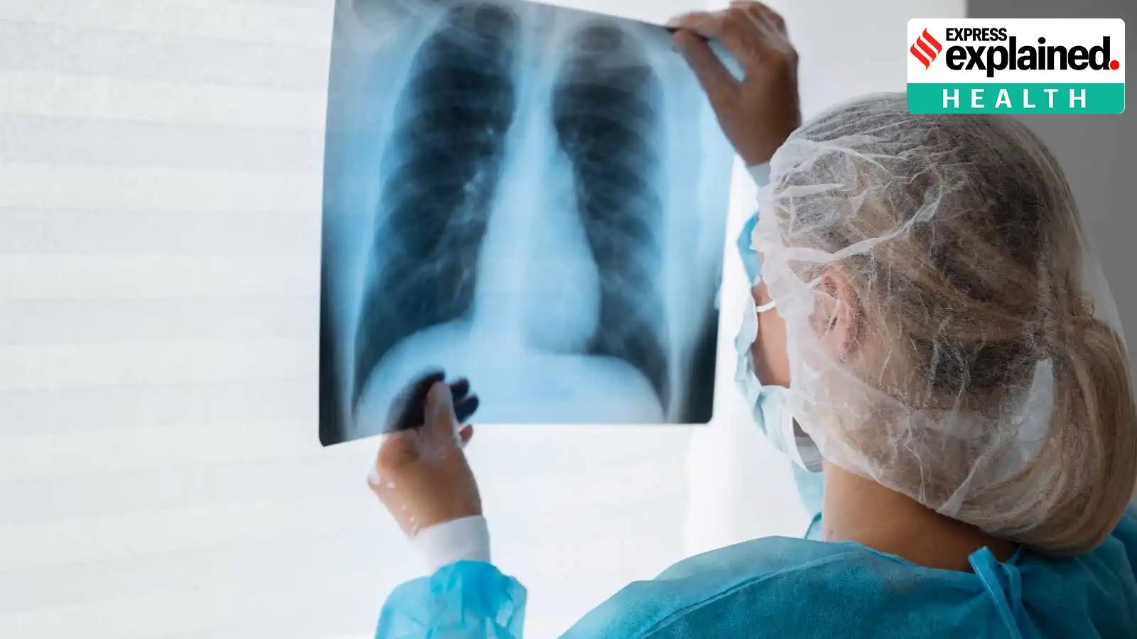 How a novel initiative helped Tamil Nadu bring down TB deaths in the state