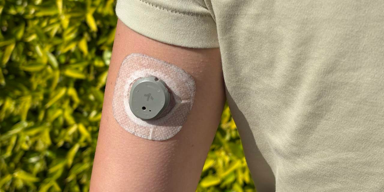A Glucose Monitor for Someone Without Diabetes: Optimal or Overkill?