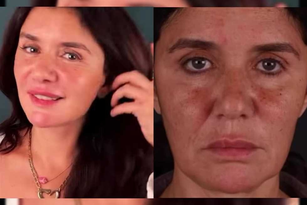 غادة عادل تفاجئ جمهورها بعملية «شد وجه».. وتعلق: رجعت 15 سنة ورا (فيديو)