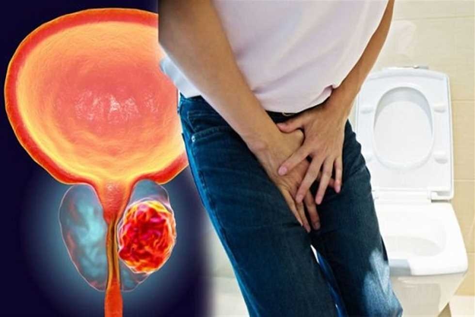 منها «الذهاب بكثرة إلى الحمام ».. 6 علامات مبكرة تدل على سرطان البروستاتا يتم تجاهلها