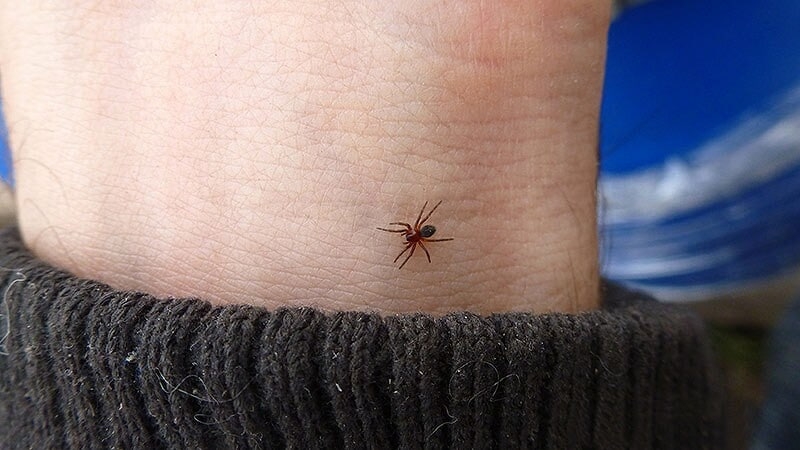 Fast Five Quiz: Are You Prepared to Confront Spider Bites?