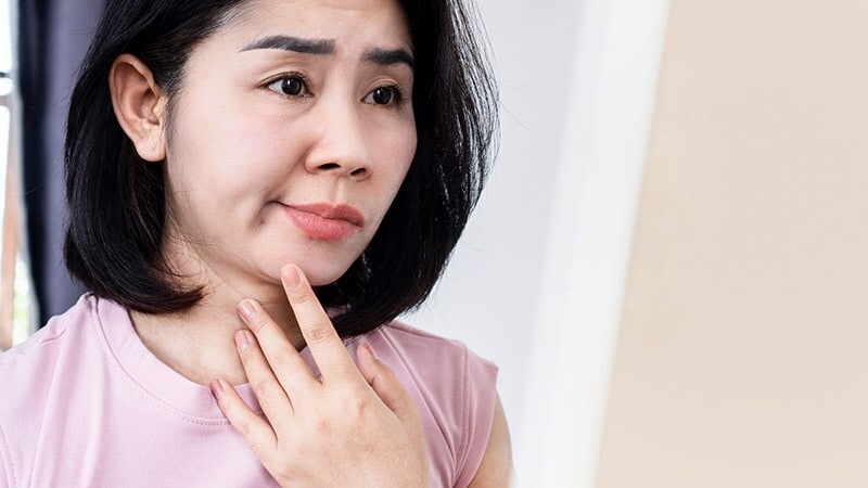 Fast Five Quiz: How Much Do You Know About Bell's Palsy?