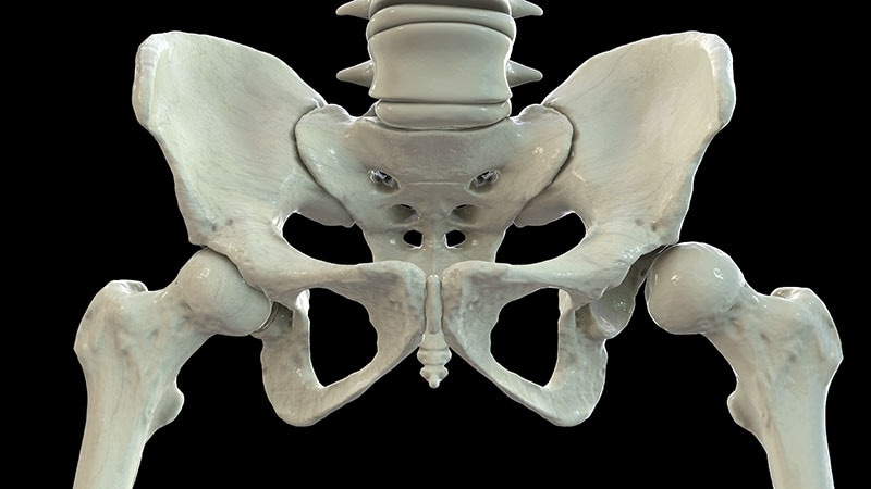 Fast Five Quiz: Achondroplasia