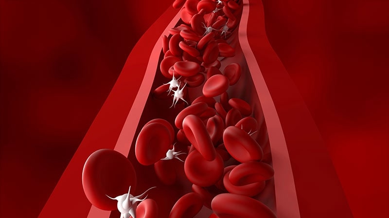 Fast Five Quiz: Immune Thrombocytopenia Complications