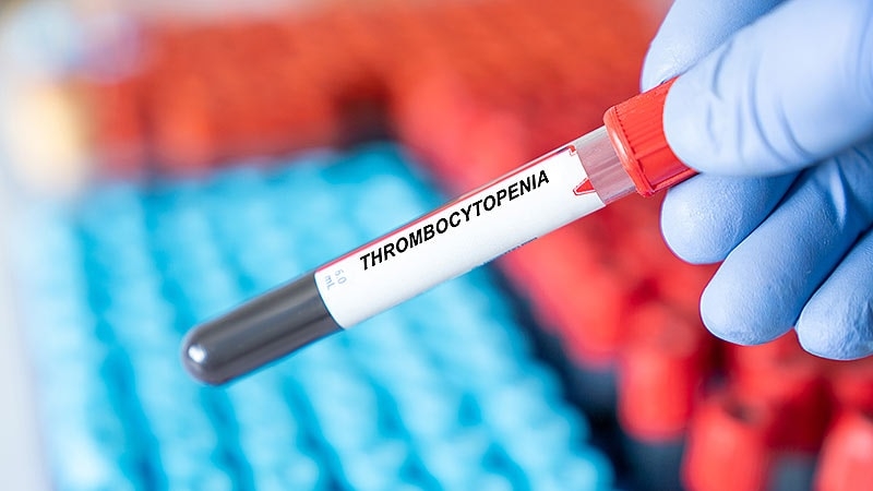 Fast Five Quiz: Immune Thrombocytopenia Pathophysiology
