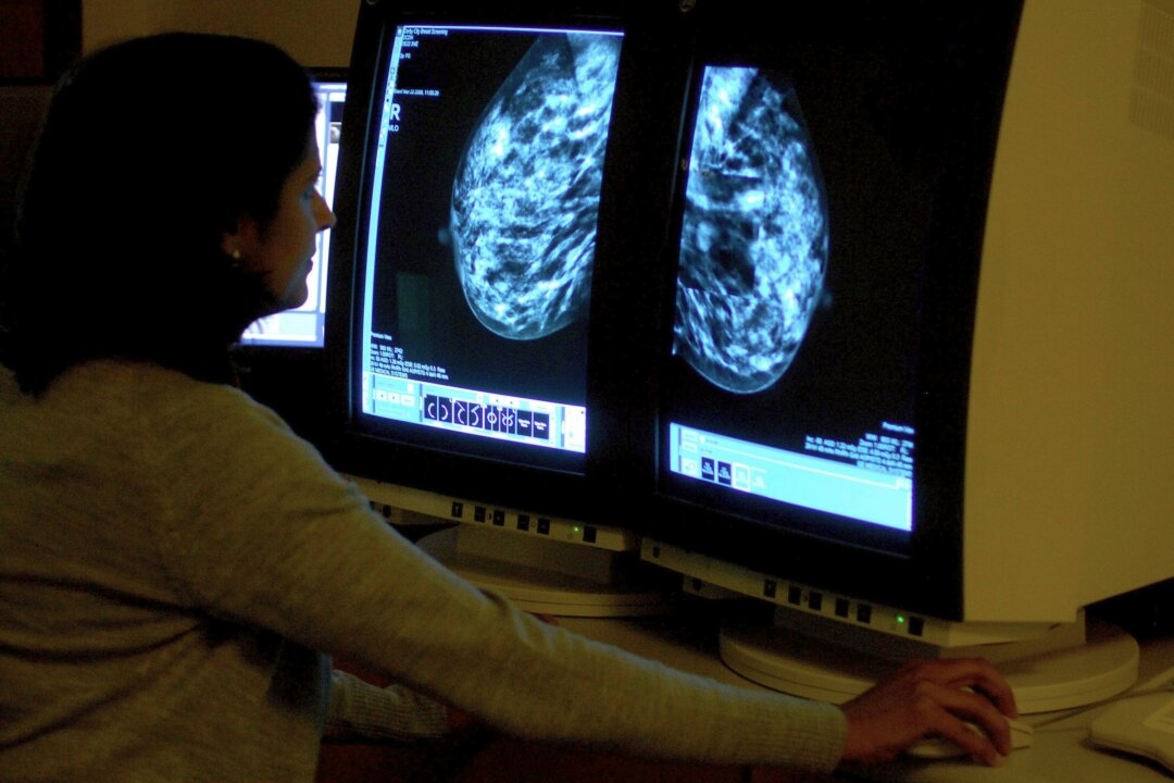 Cancer Death Rates Down More Than 20 Percent in Last 50 Years but Cases Rising: Report