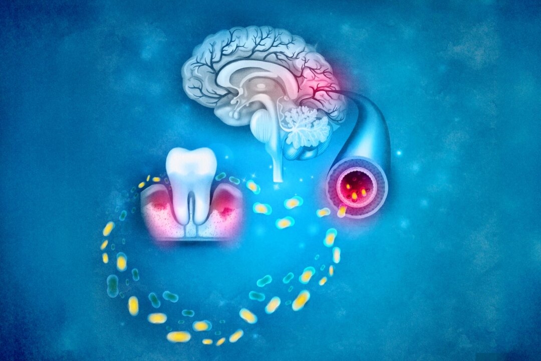 Oral Health Could Shape Cognitive Decline, and Ways to Improve It