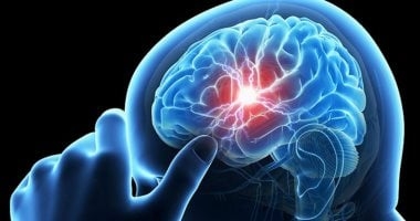 الدقيقة تحدث فرقا.. علامات مبكرة لجلطة المخ تلزم اللجوء للطبيب فورا