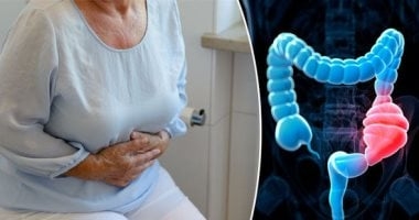 مش بس شرب المياه.. علاجات منزلية للإمساك