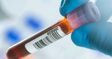بواسطة الذكاء الاصطناعي.. اختبار دم يمكنه اكتشاف 12 نوعًا من السرطان