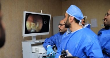 تفاصيل تقنية المناظير الجديدة لعلاج أمراض الجهاز الهضمى بمستشفى كفر الشيخ الجامعى