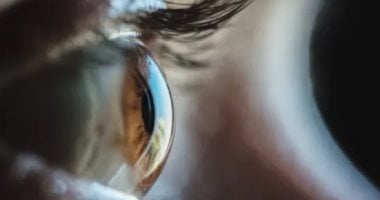 لأول مرة فى التاريخ.. جراحون يزيلون ورمًا بالعمود الفقرى من تجويف عين مريضة