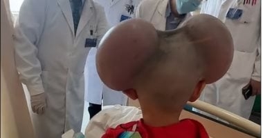 تعرض للتنمر ولقب بـ ميكى ماوس.. قصة طفل واجه حالته النادرة بشجاعة