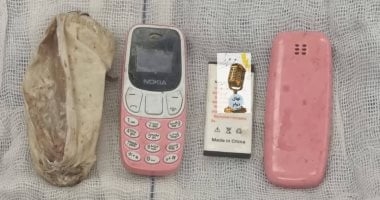 استخراج هاتف محمول من معدة مريض بمستشفى ناصر التخصصى