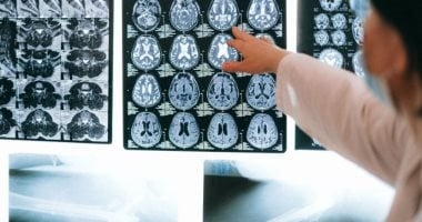 دراسة حديثة تكشف: دواء قديم للاضطرابات النفسية يساعد على الوقاية من الزهايمر