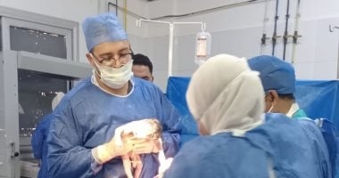 سيدة تضع 4 توائم فى ولادة حرجة بمستشفى أشمون العام بالمنوفية