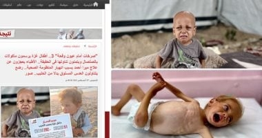 بعد نشر "اليوم السابع" قصصهم.. أطفال بغزة يسافرون مع ذويهم للعلاج بالخارج