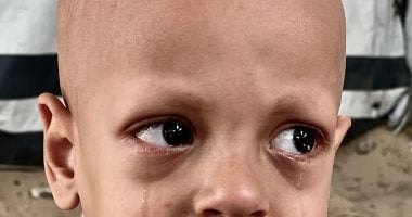 وفاة الطفل الفلسطيني صاحب عبارة "أنا جعان".. مأساة ترصدها الصور