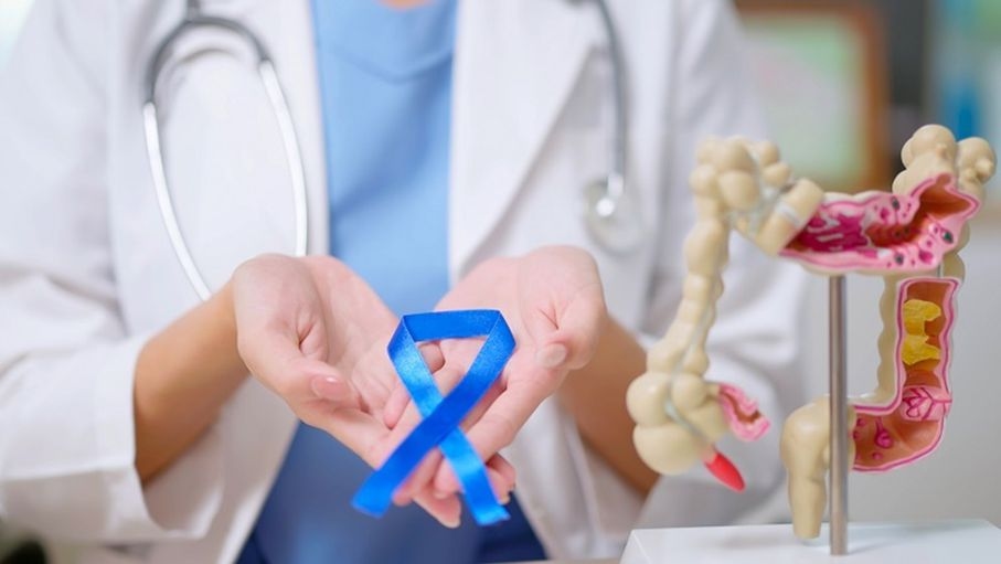 أسبرين الأطفال.. أمل جديد للوقاية من سرطان الأمعاء