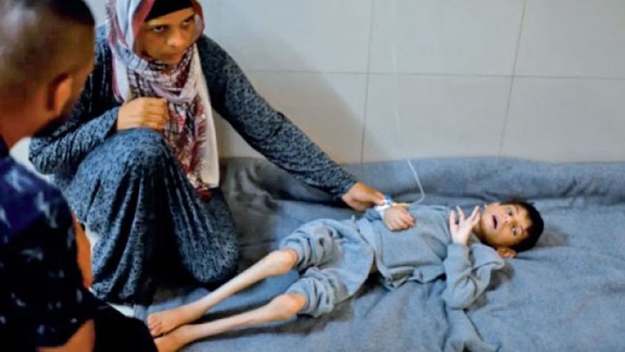 غزة: المنظومة الصحية تتهاوى والجوع يفتك بالسكان