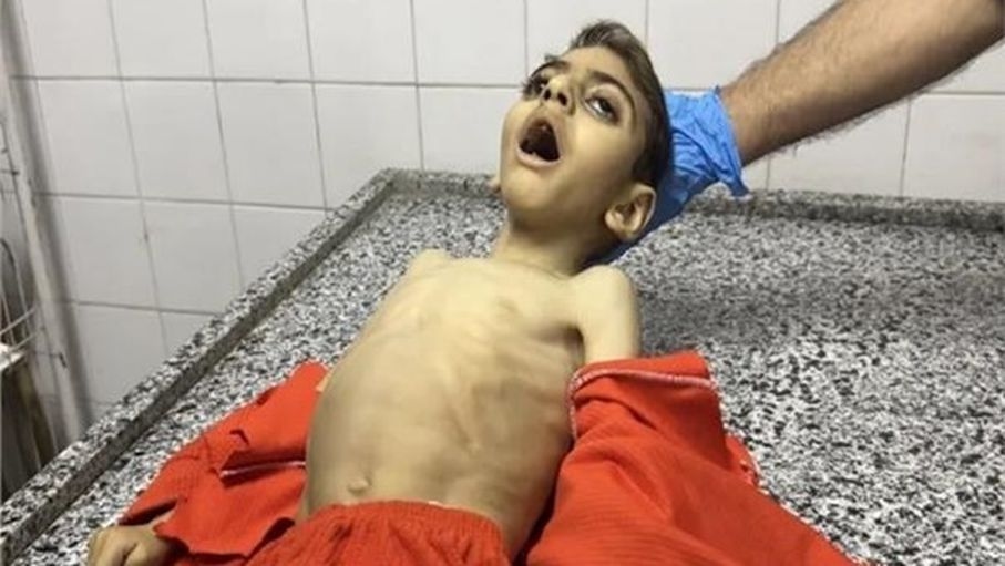 الأمم المتحدة: 96% من الأسر في غزة تواجه انعدام الأمن المائي