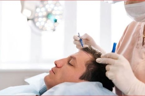 Best Hair Transplant in Turkey with Capilclinic's Award-Winning Experts