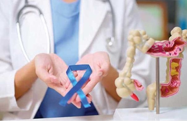 5 مشروبات طبيعية تساعد في الوقاية من سرطان القولون