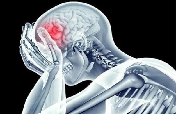 كيف يمكن تقليل خطر الإصابة بالسكتة الدماغية من خلال...