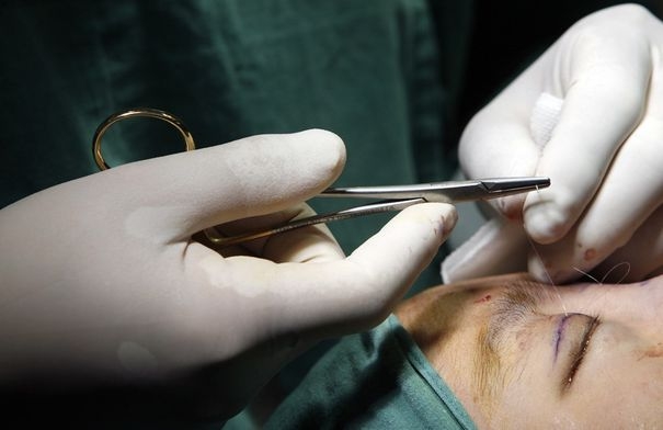 نقيب الأطباء يحذر من التعدي على مهنة الطب التجميلي