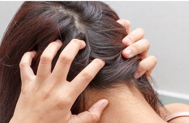 أسباب حرقة فروة الراس.. تعرف عليها