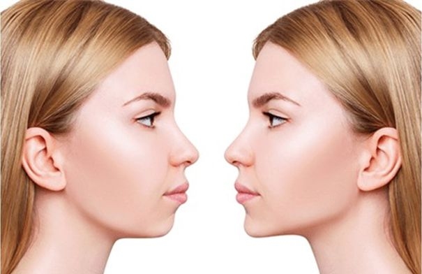 أحدث تقنيات تجميل لنحت الفك لعام 2025 بدون جراحة