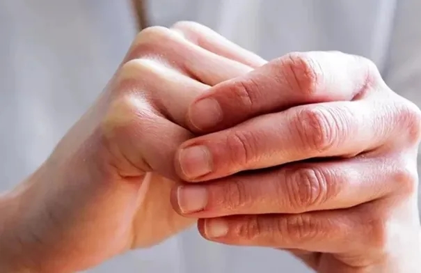5 علامات في اليدين قد تشير إلى مشاكل صحية خطيرة