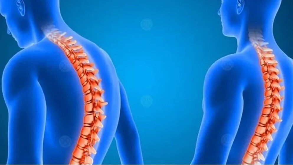 Jordanian Research Team Registers Patent for Spinal Curvature Treatment Device - Jordan News