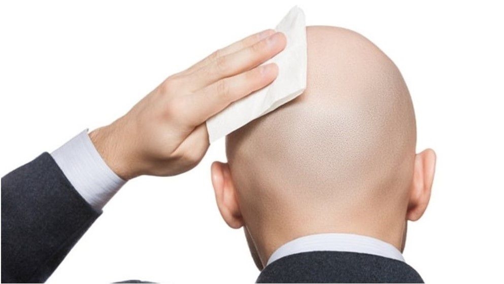 A Simple Habit That Could Lead to Baldness - Jordan News