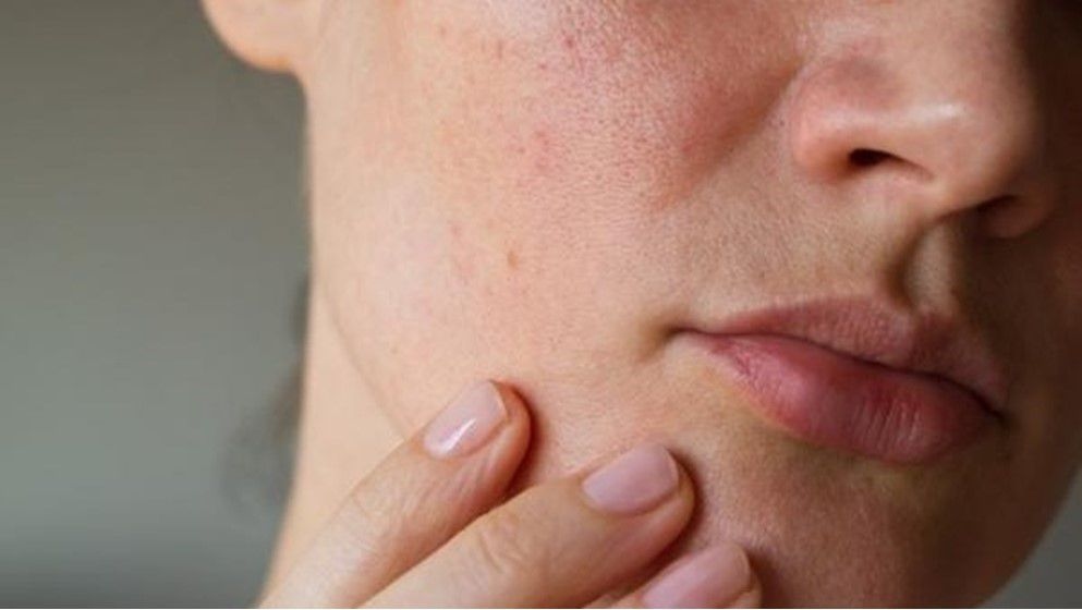 The 7-Minute Morning Routine for Oily or Combination Skin - Jordan News