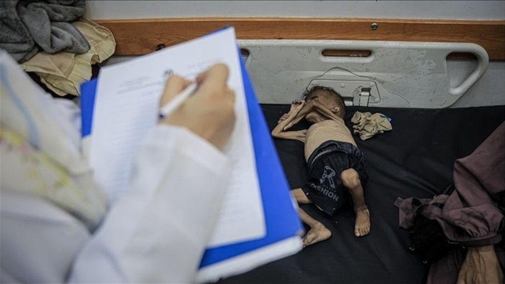 Mohammed Asfour: Another Infant Dies from Israeli-Induced Starvation in Gaza - Jordan News
