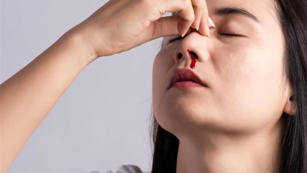 Nosebleeds: Causes, Why They Increase in Summer, and Prevention Tips - Jordan News