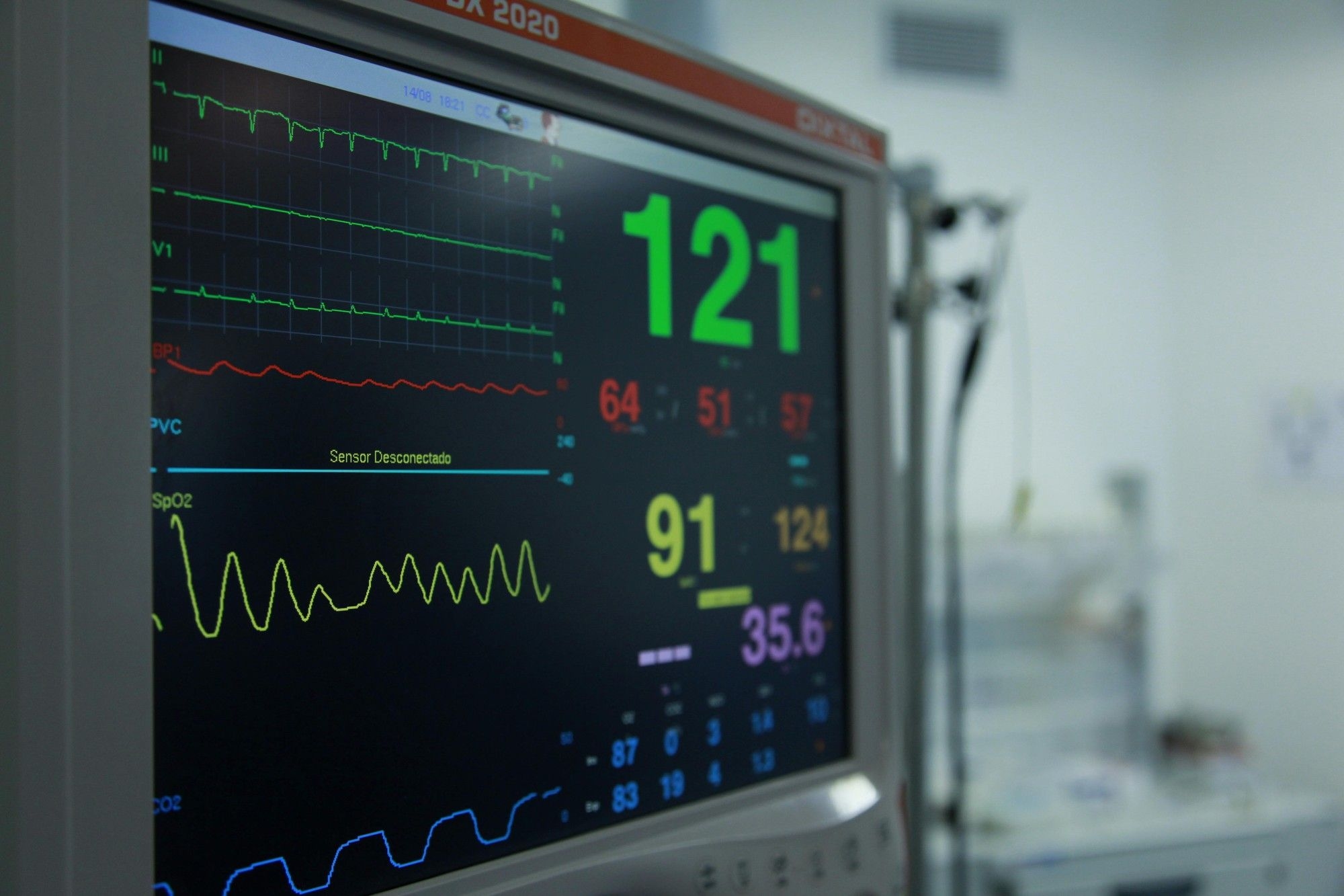 70 Eastern Cape learners hospitalised after suspected food poisoning